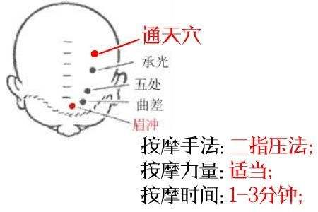 通天穴的作用与功效，通天的准确位置图