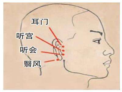 耳门穴的功效作用，耳门的准确位置图片
