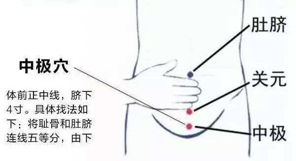 中极穴的作用，中极的准确位置图片