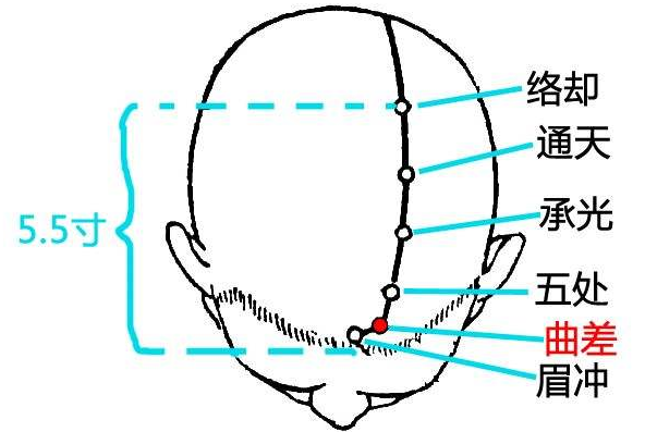 曲差怎么读？曲差穴怎么找？曲差的准确位置图和作用