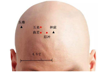 曲差怎么读？曲差穴怎么找？曲差的准确位置图和作用