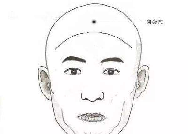 囟会怎么读？囟会穴的作用，囟会的准确位置图片