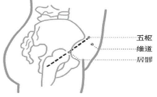 居髎在什么位置，居髎的作用功能主治