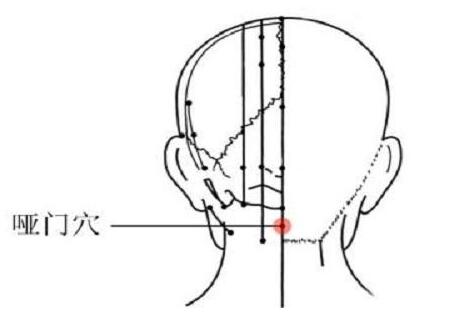哑门的定位与主治，哑门的准确位置图和作用