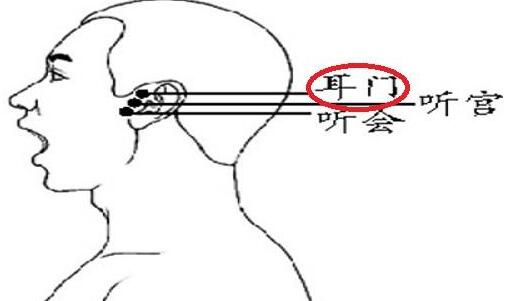 什么是耳门，耳门的准确位置图和作用