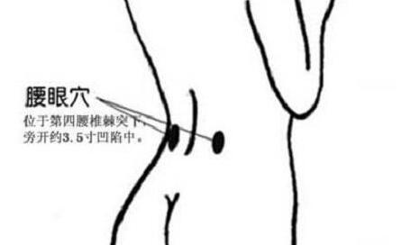 腰眼最笨的找法，腰眼疼是怎么回事？