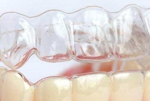 带牙套的年龄限制么，女孩戴牙套的最佳年龄是多少