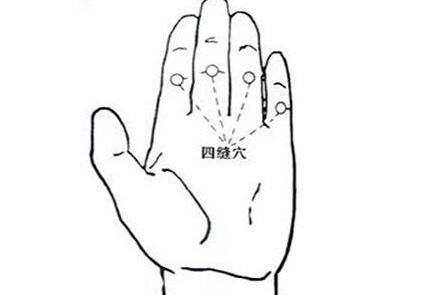 四缝的功效与作用，四缝穴的准确位置图