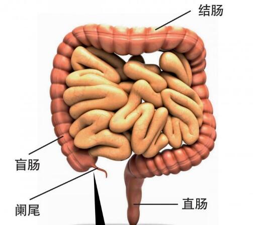 怎么判断是不是阑尾炎,阑尾在哪个位置图片
