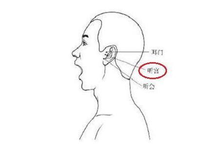 听宫的位置和功效，听宫的准确位置图和作用