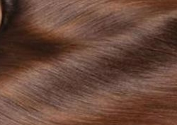 头皮屑多是什么原因，头皮屑多怎么办