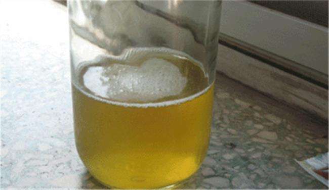 早晨第一泡尿有白色泡沫怎么回事？有病吗？