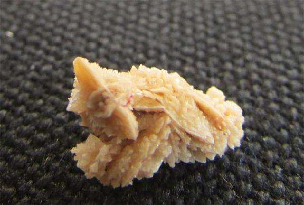 肾结石怎么引起的？肾结石不能吃什么食物？