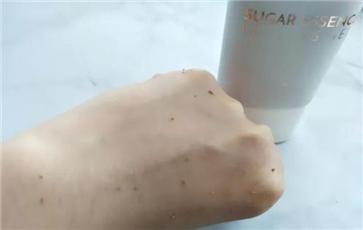 冬季皮肤保养的方法有哪些 吃这些水果告别皮肤干燥