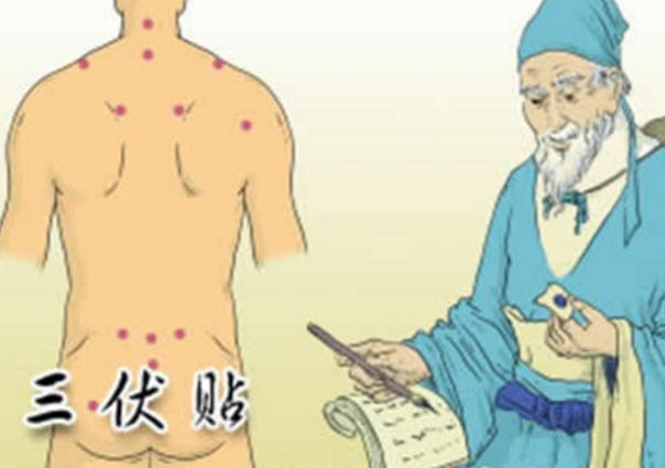 三伏贴怎么贴，三伏贴穴位有哪些