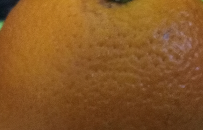 夜里牙疼教你一分钟快速止疼，大晚上牙疼如何睡眠