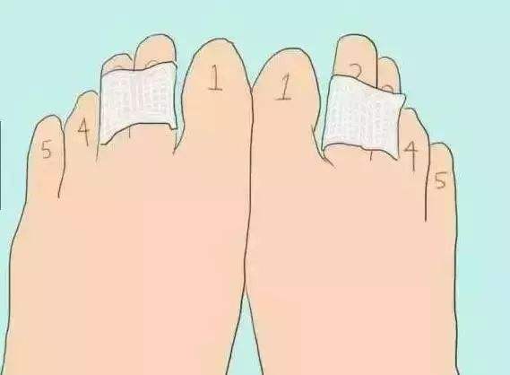 脚痛怎么办？脚痛怎么回事？如何快速止痛