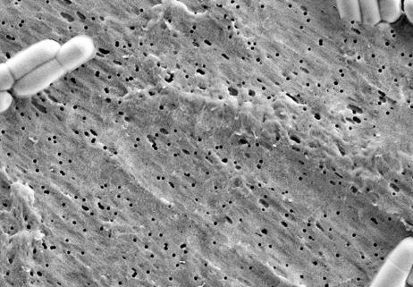 益生菌的作用与功效，益生菌副作用太大了