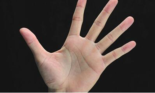 导致手心容易潮湿经常出汗的原因