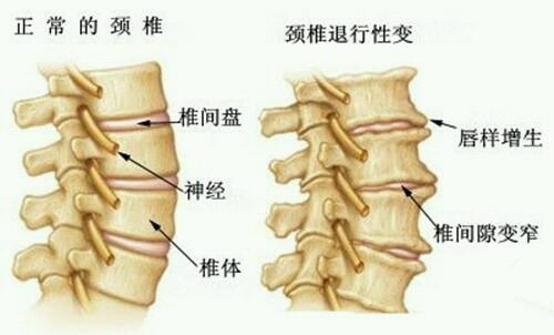 老年人关节骨病应该中医保守治疗