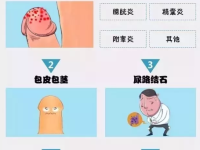 射精疼痛的原因是什么 射精疼痛该怎么办