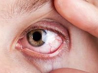 秋冬季眼睛干涩、睁不开怎么办?补充叶黄素哪个牌子好