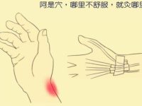 什么是阿是穴，怎么找阿是穴最简单