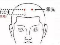 承光穴怎么找，承光的准确位置图片和作用