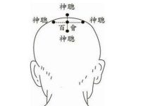 四神聪穴的功效与作用，四神聪的准确位置图