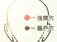 强间穴怎么找，强间的准确位置图和作用