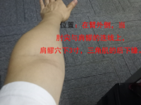 臑会怎么拼音？臑会穴的准确位置图和作用