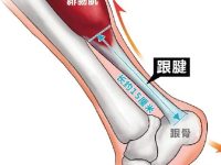 跟腱炎是哪个部位？跟腱炎按摩什么穴位好？
