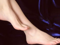 脚后跟干裂是缺乏维生素吗 脚后跟干裂起硬皮的原因