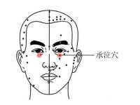 承泣穴的作用与功效，承泣的准确位置图片