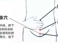 中极穴的作用，中极的准确位置图片