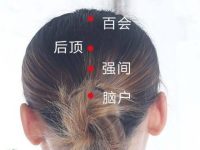 后顶穴的作用与功效，后顶的准确位置图