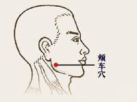 颊车穴怎么找，颊车的作用，颊车的准确位置图