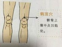 鹤顶穴如何找，鹤顶的准确位置图和作用