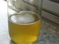 早晨第一泡尿有白色泡沫怎么回事？有病吗？