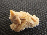 肾结石怎么引起的？肾结石不能吃什么食物？
