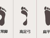 扁平足是什么？扁平足的矫正方法